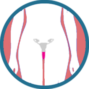 Vaginal Cancer Specialist in Delhi